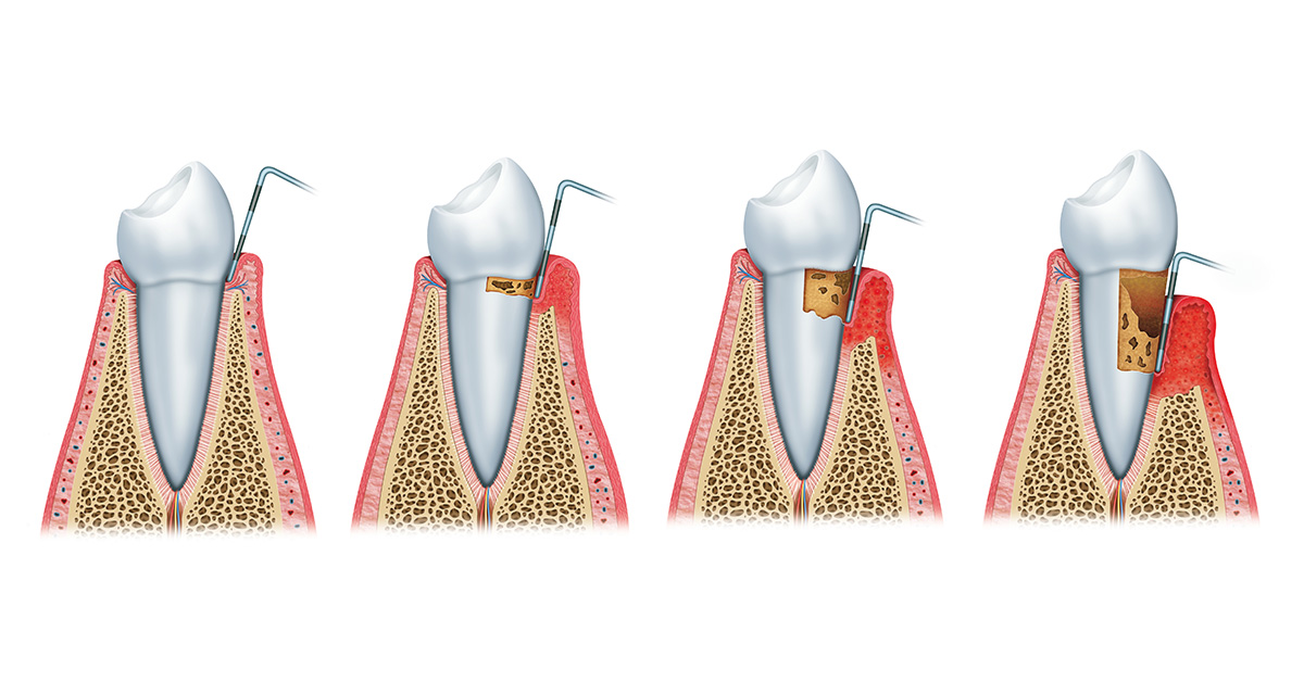 clinica dental periodòncia